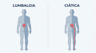 diferencia dolor lumbar y dolor ciatica